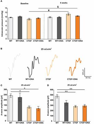 Enhanced glaucomatous damage accompanied by glial response in a new multifactorial mouse model